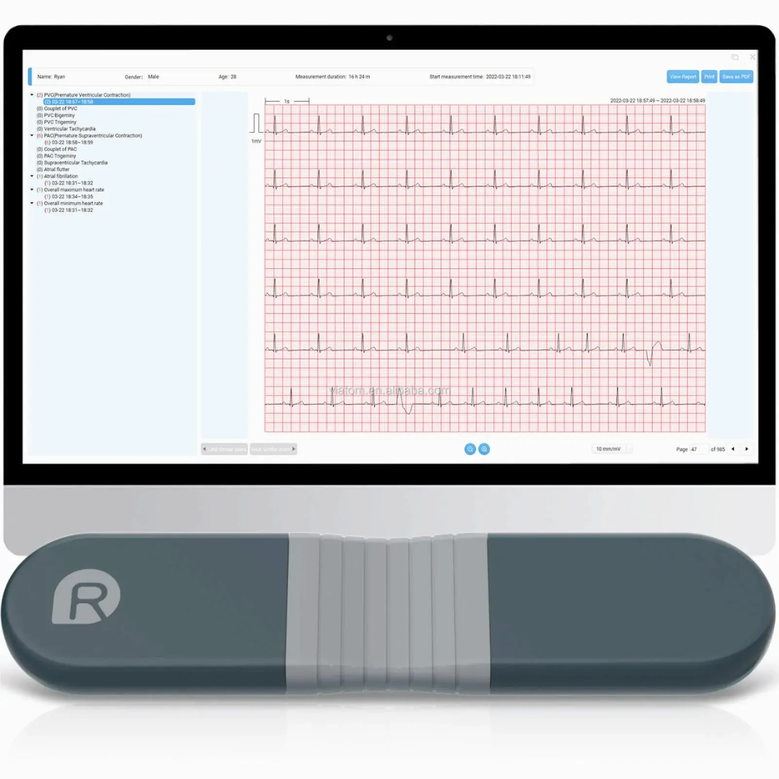 Wireless Bluetooth Dynamic Rec - Ecg Patch Monitor recension och pris